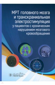 МРТ головного мозга и транскраниальная электростимуляция у пациентов с хроническим нарушением