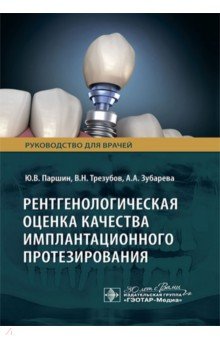 Рентгенологическая оценка качества имплантационного протезирования. Руководство