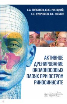 Активное дренирование околоносовых пазух при остром риносинусите