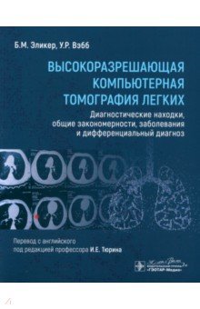 Высокоразрешающая компьютерная томография легких. Диагностические находки, общие закономерности