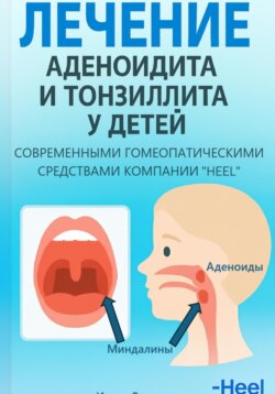 Лечение аденоидита и тонзиллита у детей современными комплексными гомеопатическими препаратами фирмы &laquo;Хеель&raquo;