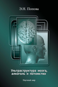 Ультраструктура мозга, алкоголь и потомство
