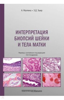 Интерпретация биопсий шейки и тела матки