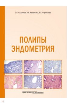 Полипы эндометрия. Учебное пособие