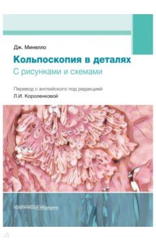 Кольпоскопия в деталях с рисунками и схемами