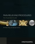 Pain-Relieving Procedures. The Illustrated Guide