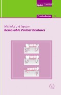 Removable Partial Dentures