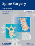 Spine Surgery