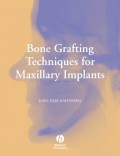 Bone Grafting Techniques for Maxillary Implants