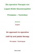 Die operative Therapie von Lippen-Kiefer-Gaumenspalten   Prinzipien  - Techniken   Deutsch   English   An approach to operative cleft lip and palate therapy   Principles - Techniques