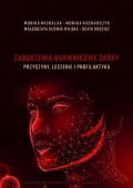 Zaburzenia barwnikowe skóry – przyczyny, leczenie i profilaktyka