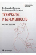 Туберкулез и беременность. Учебное пособие