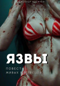 Язвы