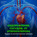 Оздоровление сосудов, от атеросклероза