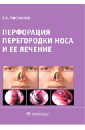 Перфорация перегородки носа и ее лечение