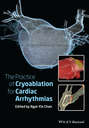 The Practice of Catheter Cryoablation for Cardiac Arrhythmias