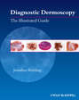 Diagnostic Dermoscopy. The Illustrated Guide