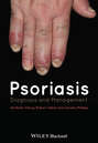 Psoriasis. Diagnosis and Management