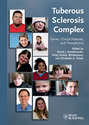 Tuberous Sclerosis Complex. Genes, Clinical Features and Therapeutics