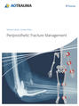 Periprosthetic Fracture Management