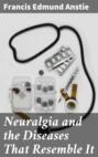 Neuralgia and the Diseases That Resemble It