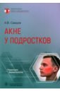 Акне у подростков. Руководство