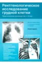 Рентгенологическое исследование грудной клетки. Практическое руководство. Атлас