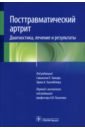 Посттравматический артрит. Диагностика, лечение и результаты